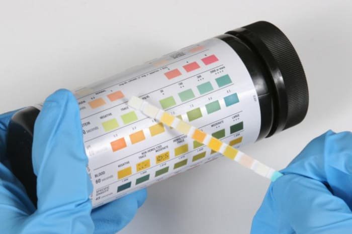 Checking the results of a reagent modafinil urine test